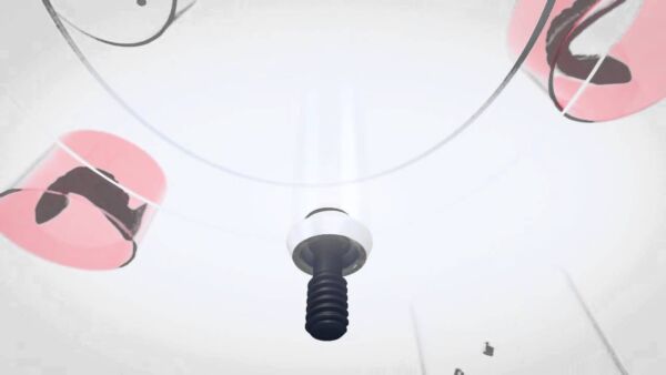 NBC-Solutions / Nobel Biocare AG